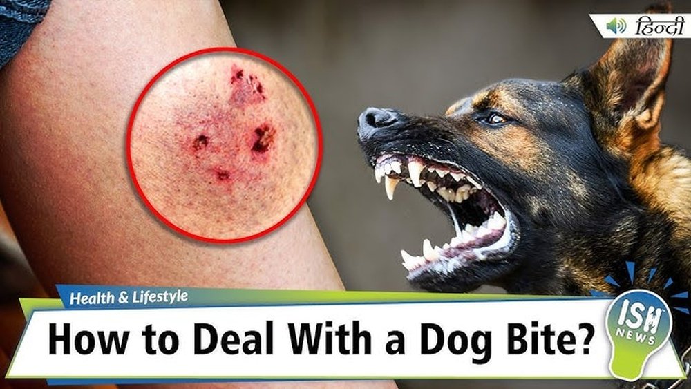What Will Happen If a Stray Dog Bites You